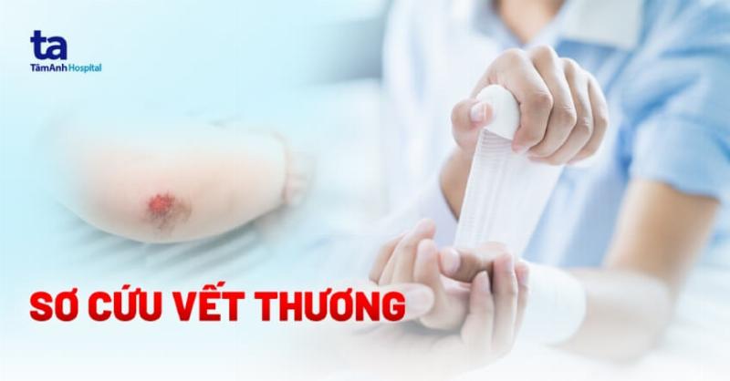 Hình ảnh mô tả các loại vết xước sâu, nghiêm trọng trên bề mặt xe máy sau khi bị ngã, cho thấy sự khác biệt giữa vết xước nhẹ, vết xước vào lớp sơn màu và vết xước lộ kim loại.